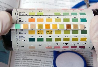 Blut im urin durch viagra